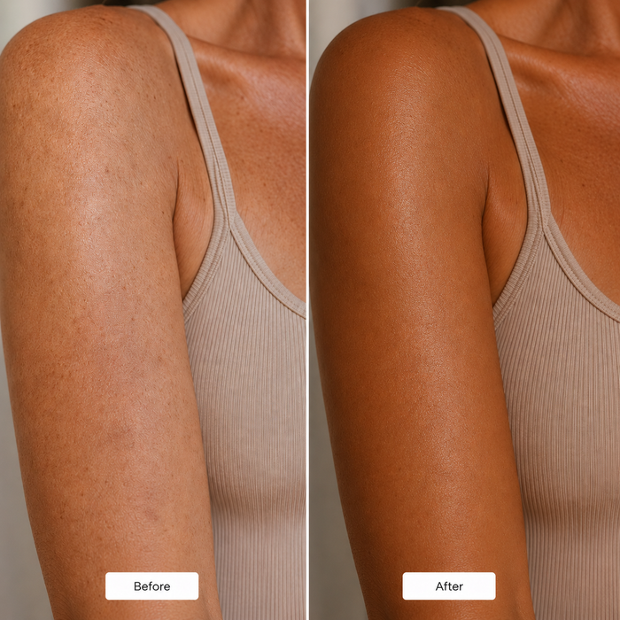 4. Dark Spots and Uneven Tone Started Fading